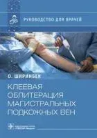 Клеевая облитерация магистральных подкожных вен - 2022 год