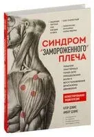 Синдром "замороженного" плеча. Терапия триггерных точек для преодоления боли и восстановления диапазона движений - 2023 год