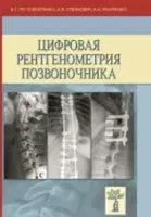 Цифровая рентгенометрия позвоночника - А. Мазуренко, Владлен Пустовойтенко, А. Смеянович - 2020 год