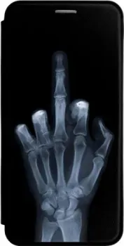 JFK для Poco F4 (X-Ray)