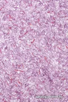 Bioplast 611